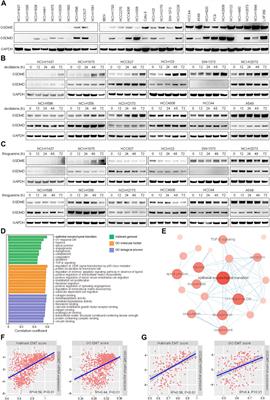 Epithelial-Mesenchymal Transition Induces GSDME Transcriptional Activation for Inflammatory Pyroptosis